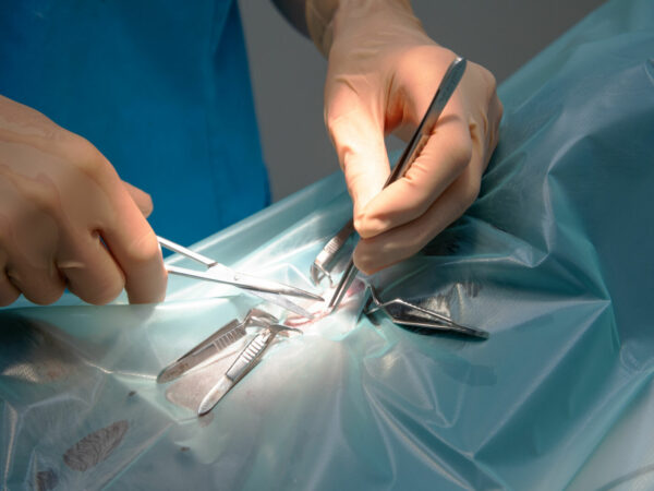 Start OR (surgery)